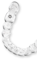 Aligners